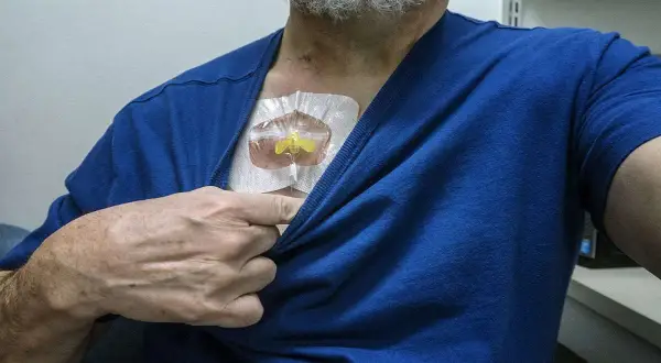 A man lifts his blue shirt to reveal a medical port on his chest. He's wondering, "Can you swim with a port?