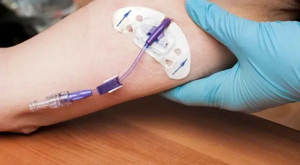 A gloved hand secures a PICC line dressing on an arm. This image may help answer if you can swim with a PICC line.