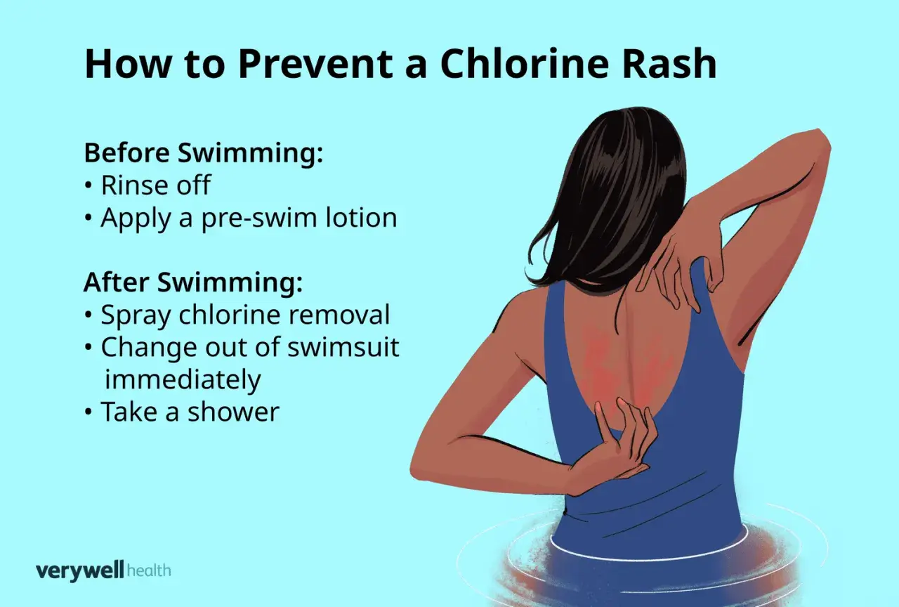 Illustration showing a person scratching a red rash on their back, likely an allergic reaction to chlorine. Tips for prevention are listed.