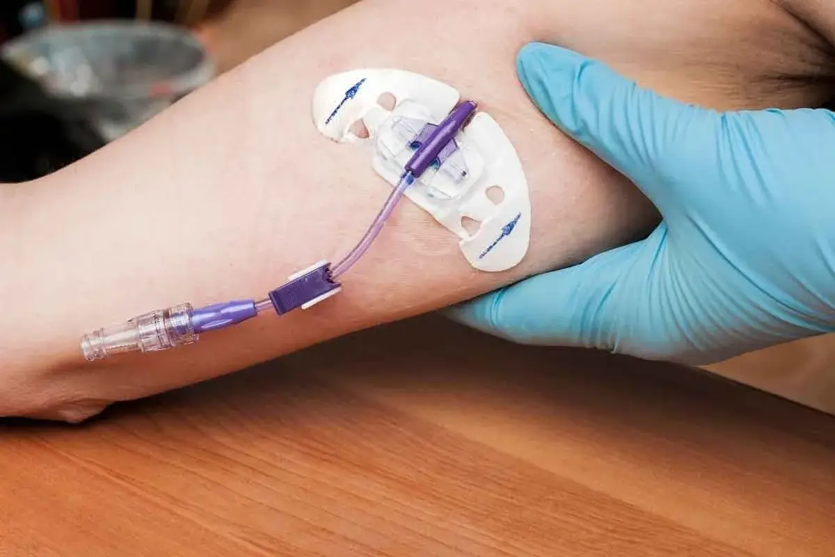 A gloved hand secures a PICC line dressing on an arm. This image may help answer if you can swim with a PICC line.
