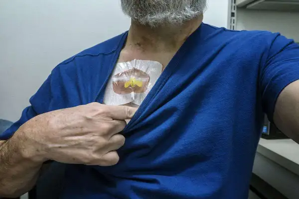 A man lifts his blue shirt to reveal a medical port on his chest. He's wondering, "Can you swim with a port?